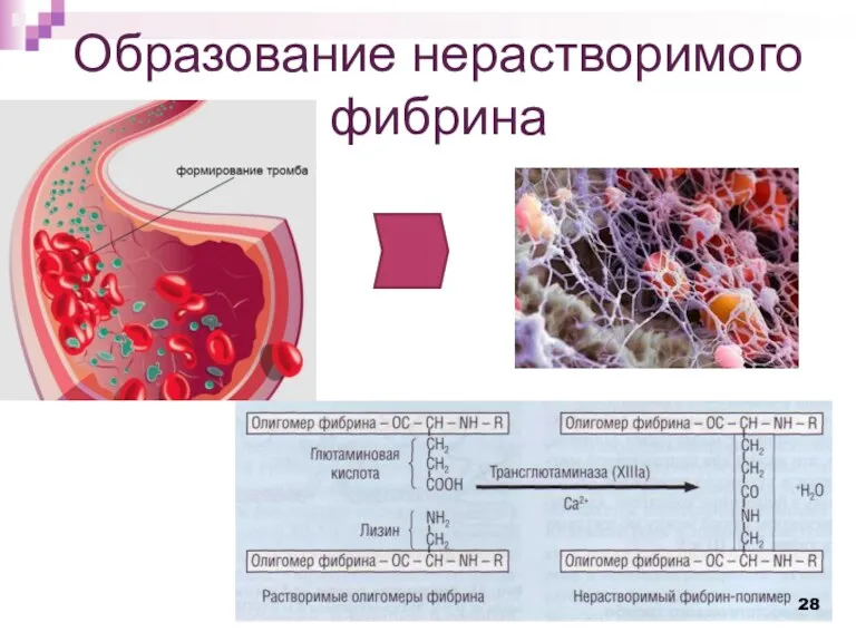 Образование нерастворимого фибрина