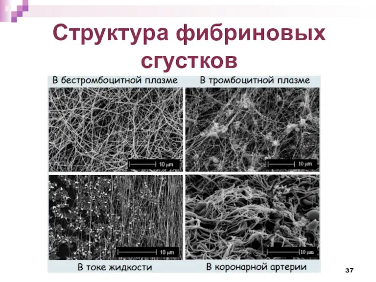 Структура фибриновых сгустков