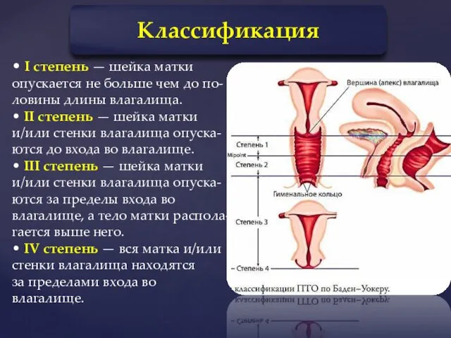 Классификация • I степень — шейка матки опускается не больше