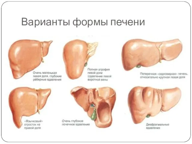 Варианты формы печени