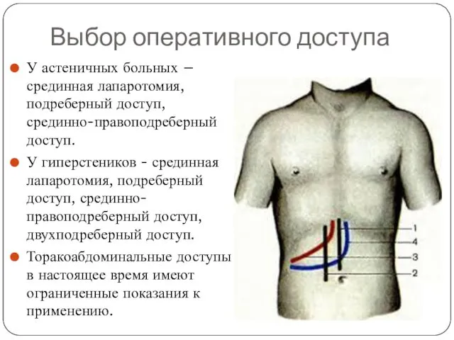 Выбор оперативного доступа У астеничных больных – срединная лапаротомия, подреберный