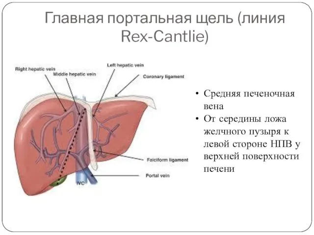 Главная портальная щель (линия Rex-Cantlie) Средняя печеночная вена От середины