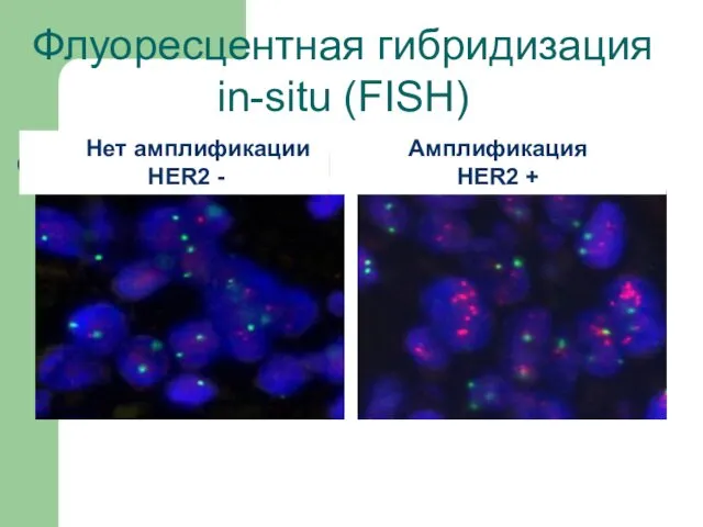 Флуоресцентная гибридизация in-situ (FISH) Амплификация HER2 + Нет амплификации HER2 -