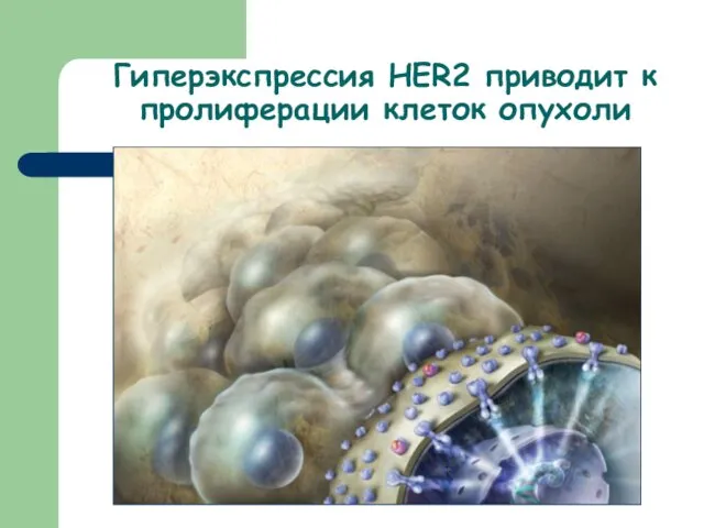 Гиперэкспрессия HER2 приводит к пролиферации клеток опухоли