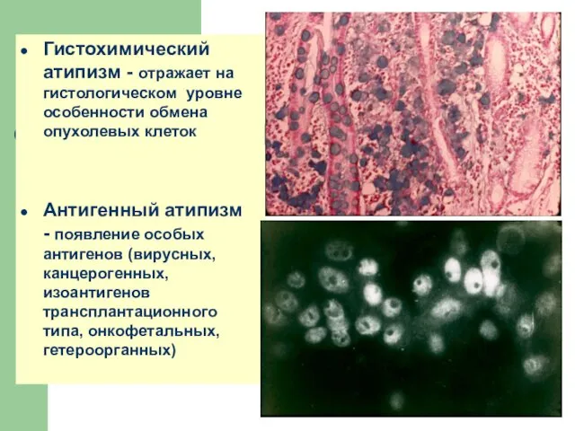 Гистохимический атипизм - отражает на гистологическом уровне особенности обмена опухолевых клеток Антигенный атипизм