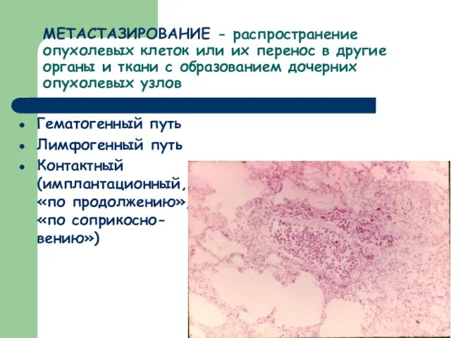 МЕТАСТАЗИРОВАНИЕ - распространение опухолевых клеток или их перенос в другие органы и ткани