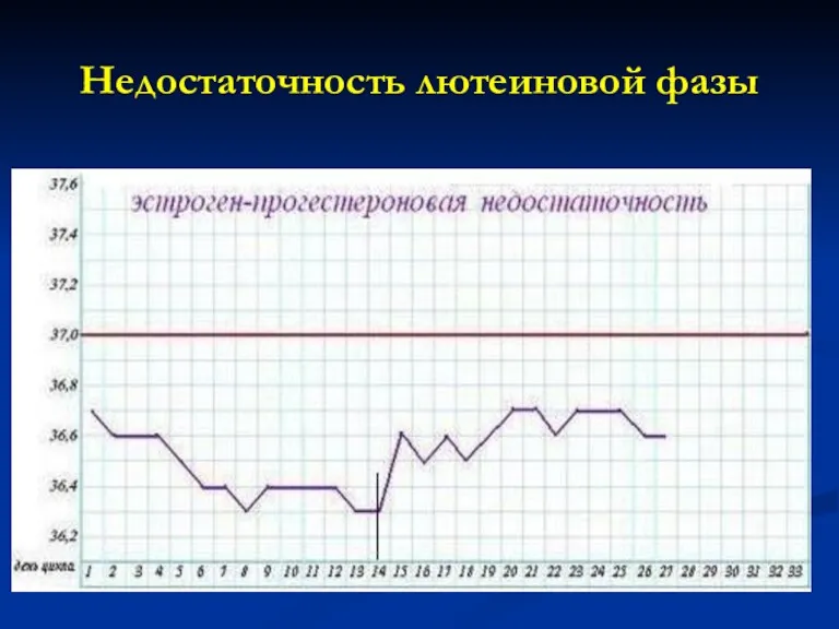 Недостаточность лютеиновой фазы