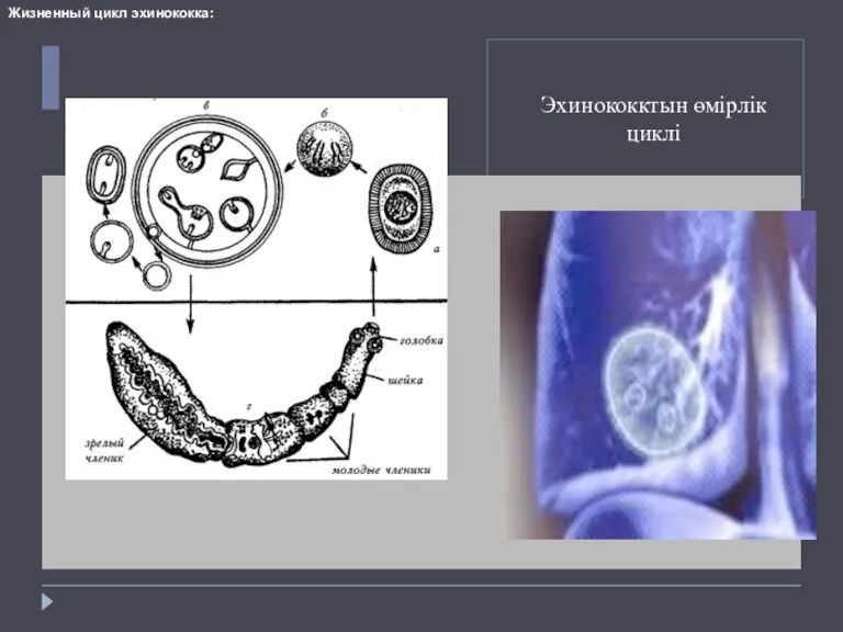 Эхинококктын өмірлік циклі Жизненный цикл эхинококка: