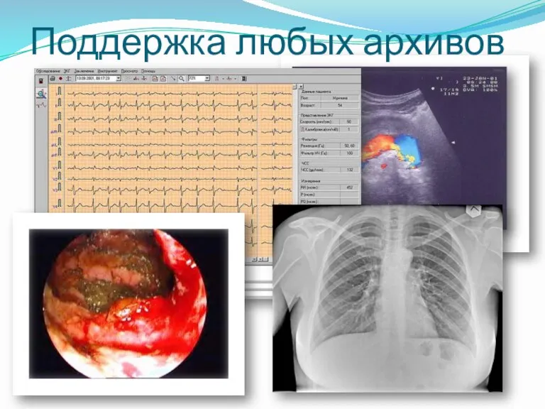 Поддержка любых архивов