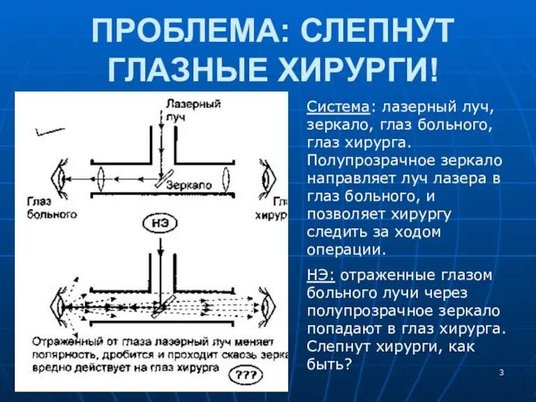 ПРОБЛЕМА: СЛЕПНУТ ГЛАЗНЫЕ ХИРУРГИ! Система: лазерный луч, зеркало, глаз больного,