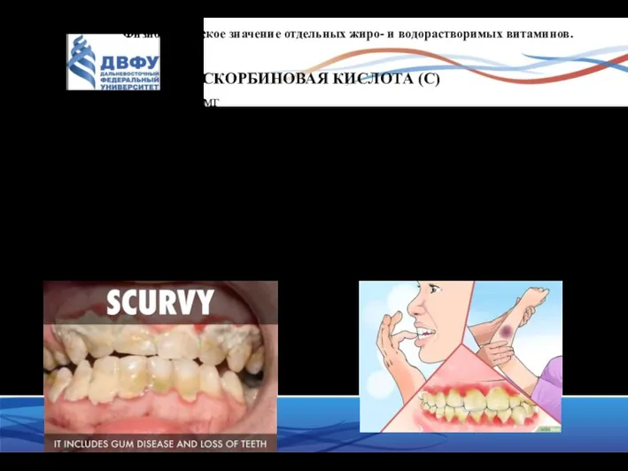 Физиологическое значение отдельных жиро- и водорастворимых витаминов. АСКОРБИНОВАЯ КИСЛОТА (С)