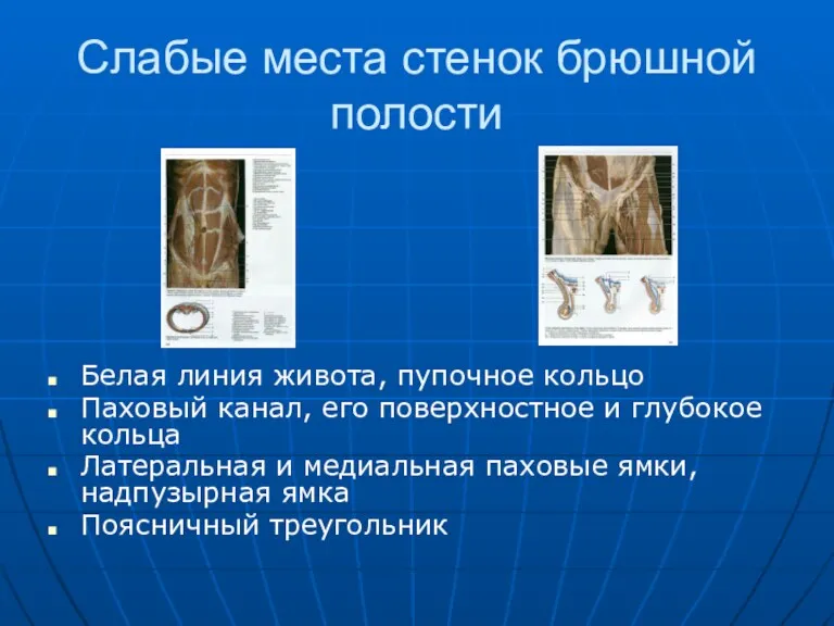 Слабые места стенок брюшной полости Белая линия живота, пупочное кольцо