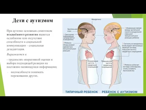 При аутизме основным симптомом искажённого развития является ослабление или отсутствие способности к социальной