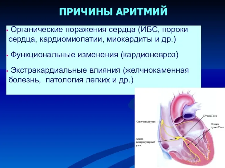 Органические поражения сердца (ИБС, пороки сердца, кардиомиопатии, миокардиты и др.)