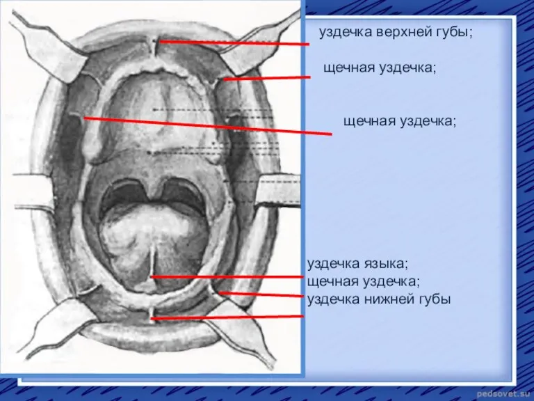 уздечка верхней губы; щечная уздечка; щечная уздечка; уздечка языка; щечная уздечка; уздечка нижней губы