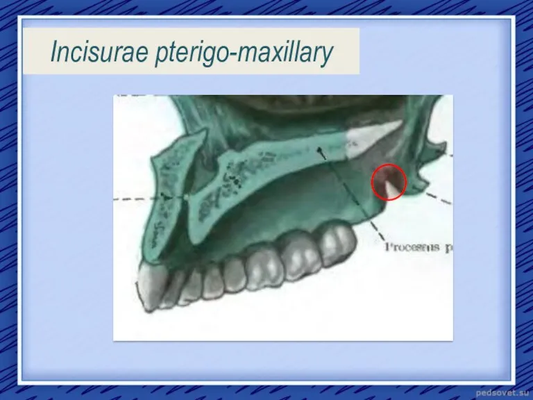 Incisurae pterigo-maxillary