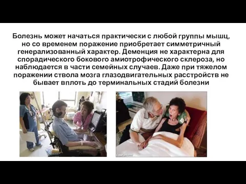 Болезнь может начаться практически с любой группы мышц, но со