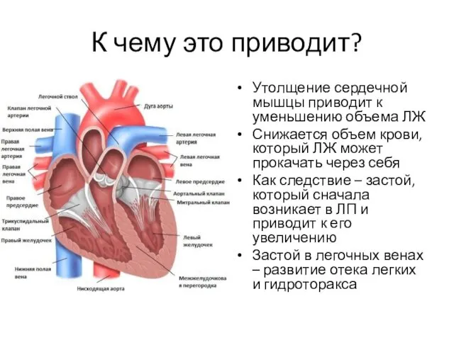 К чему это приводит? Утолщение сердечной мышцы приводит к уменьшению