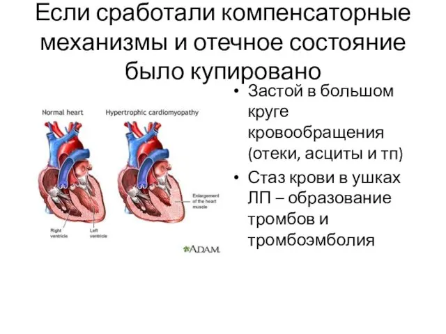 Если сработали компенсаторные механизмы и отечное состояние было купировано Застой