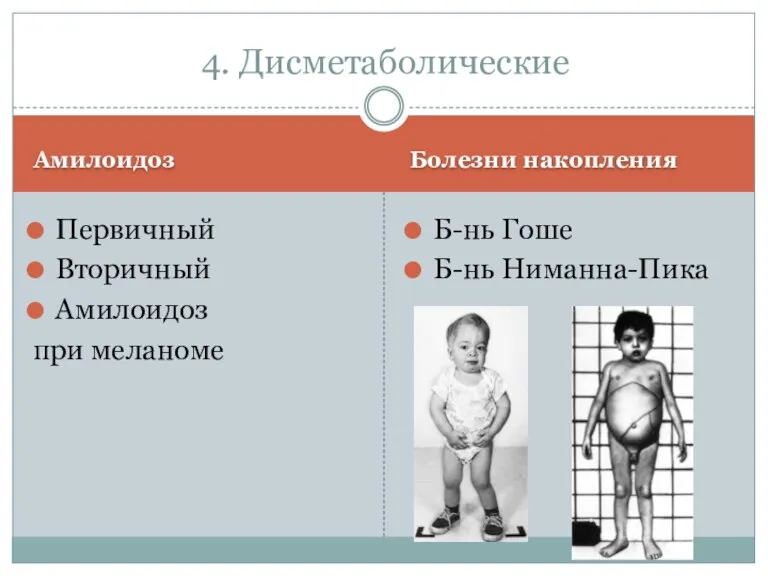 Амилоидоз Болезни накопления Первичный Вторичный Амилоидоз при меланоме Б-нь Гоше Б-нь Ниманна-Пика 4. Дисметаболические