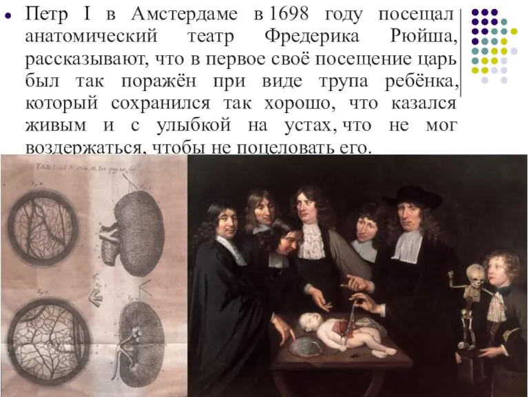 Петр I в Амстердаме в 1698 году посещал анатомический театр