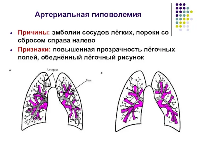 Артериальная гиповолемия Причины: эмболии сосудов лёгких, пороки со сбросом справа налево Признаки: повышенная