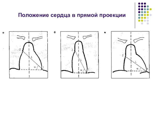 Положение сердца в прямой проекции