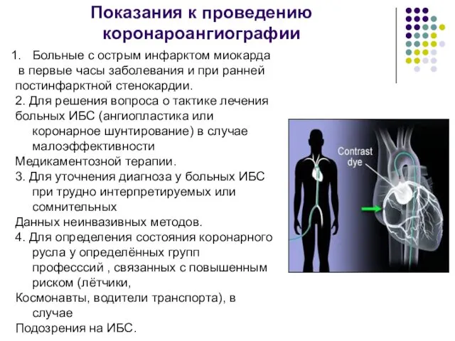 Показания к проведению коронароангиографии Больные с острым инфарктом миокарда в первые часы заболевания