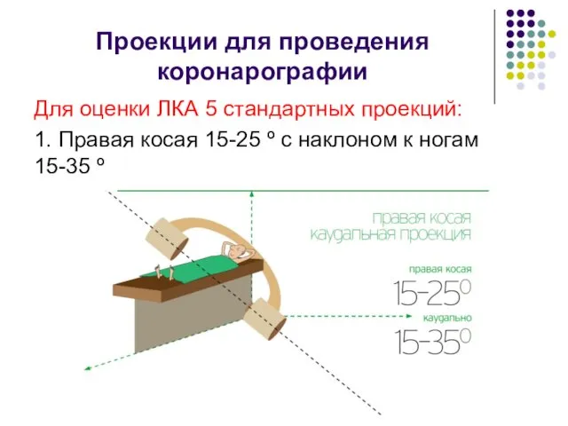 Проекции для проведения коронарографии Для оценки ЛКА 5 стандартных проекций: 1. Правая косая