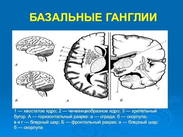 БАЗАЛЬНЫЕ ГАНГЛИИ 1 — хвостатое ядро; 2 — чечевицеобразное ядро; 3 — зрительный