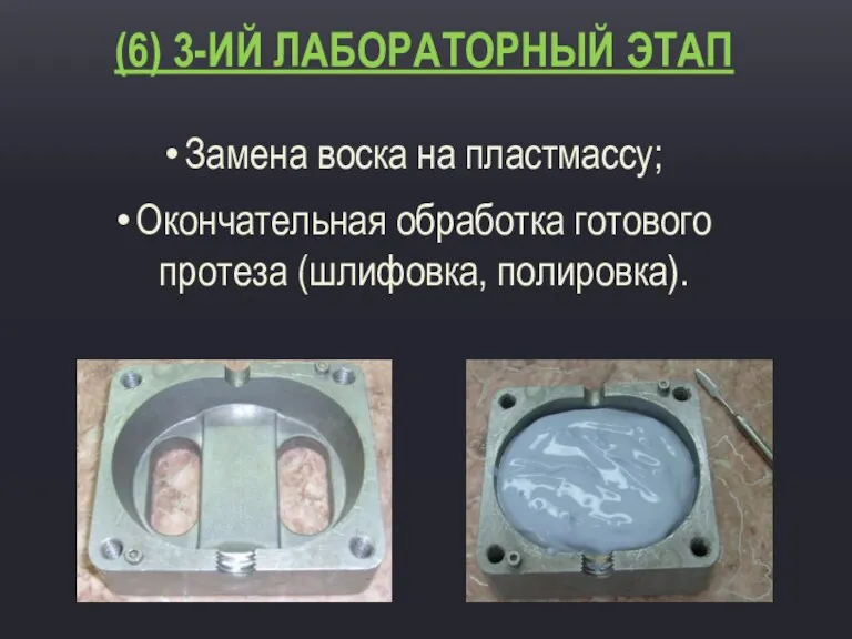 (6) 3-ИЙ ЛАБОРАТОРНЫЙ ЭТАП Замена воска на пластмассу; Окончательная обработка готового протеза (шлифовка, полировка).