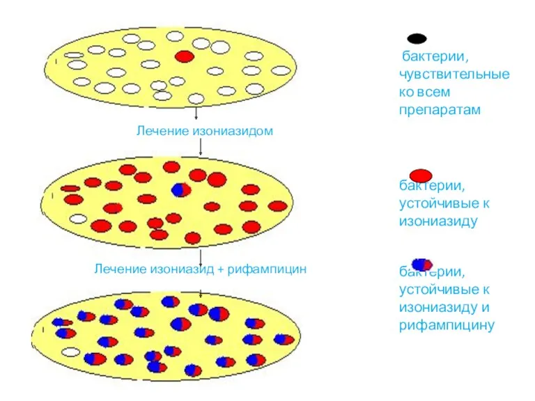 бактерии, чувствительные ко всем препаратам бактерии, устойчивые к изониазиду бактерии, устойчивые к изониазиду