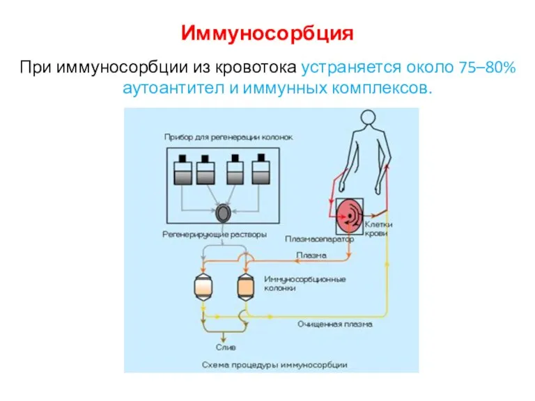 Иммуносорбция При иммуносорбции из кровотока устраняется около 75–80% аутоантител и иммунных комплексов.