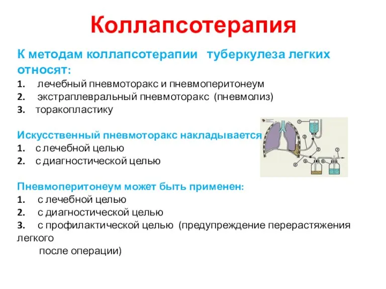 Коллапсотерапия К методам коллапсотерапии туберкулеза легких относят: 1. лечебный пневмоторакс и пневмоперитонеум 2.