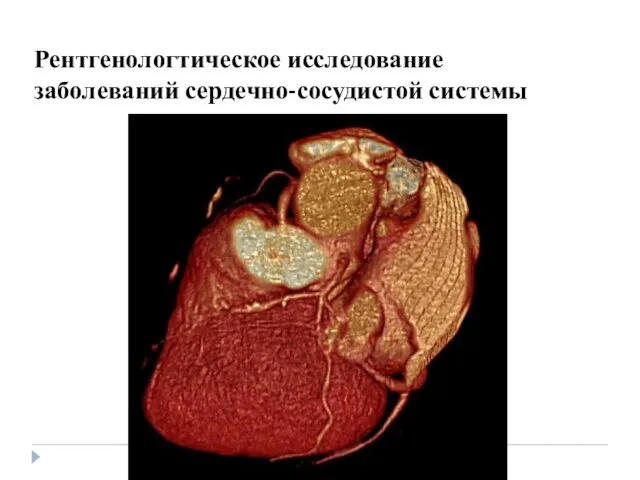 Рентгенологтическое исследование заболеваний сердечно-сосудистой системы