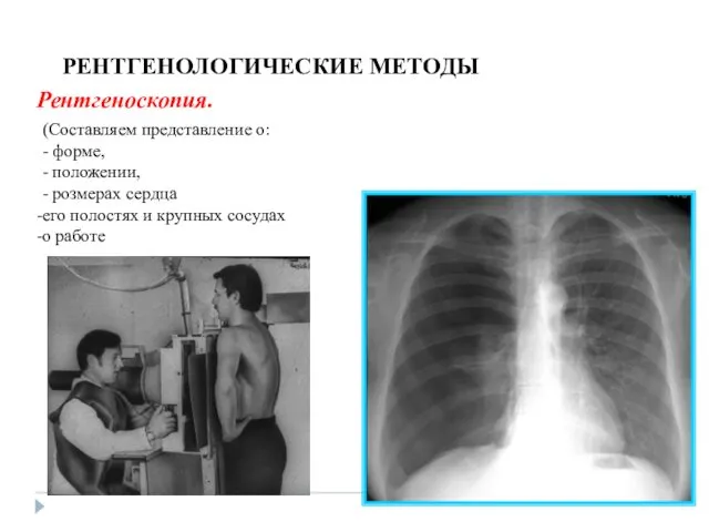 РЕНТГЕНОЛОГИЧЕСКИЕ МЕТОДЫ Рентгеноскопия. (Составляем представление о: - форме, - положении, - розмерах сердца