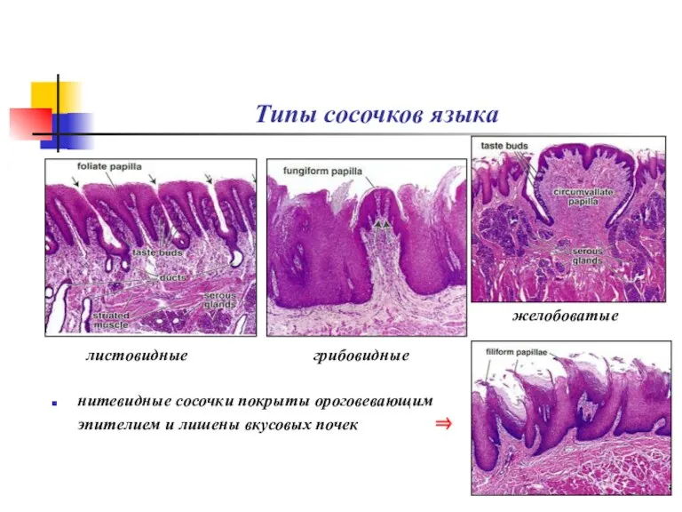 Типы сосочков языка нитевидные сосочки покрыты ороговевающим эпителием и лишены вкусовых почек ⇒ листовидные грибовидные желобоватые