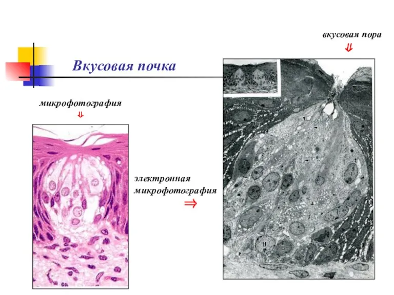Вкусовая почка вкусовая пора ⇓ микрофотография ⇓ электронная микрофотография ⇒