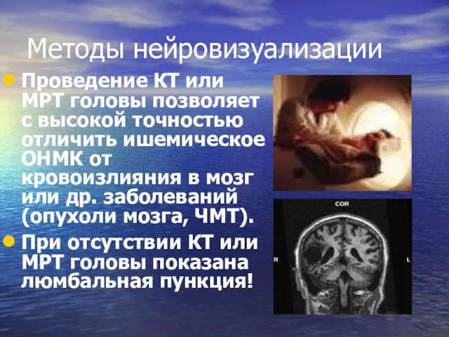 Методы нейровизуализации Проведение КТ или МРТ головы позволяет с высокой точностью отличить ишемическое
