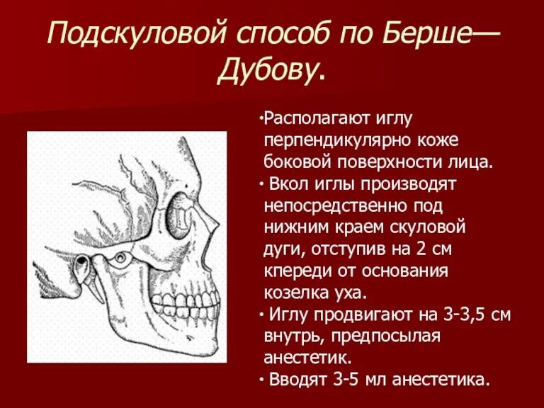 Подскуловой способ по Берше—Дубову. Располагают иглу перпендикулярно коже боковой поверхности