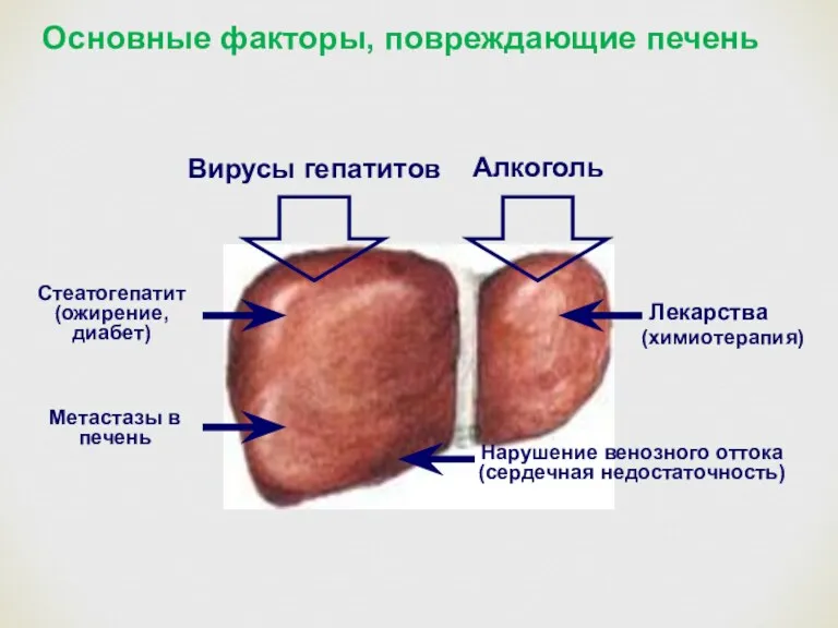 Стеатогепатит (ожирение, диабет) Нарушение венозного оттока (сердечная недостаточность) Лекарства Метастазы в печень (химиотерапия)