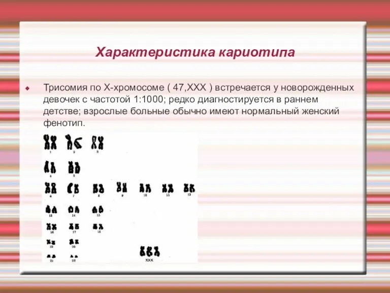 Характеристика кариотипа Трисомия по Х-хромосоме ( 47,ХХХ ) встречается у