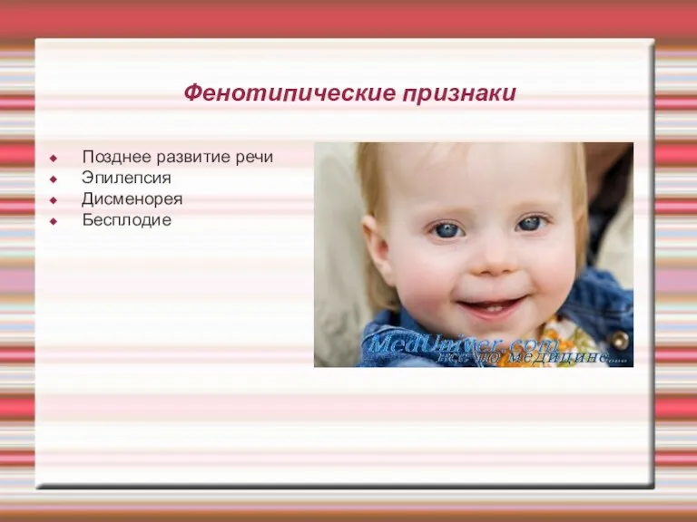 Фенотипические признаки Позднее развитие речи Эпилепсия Дисменорея Бесплодие
