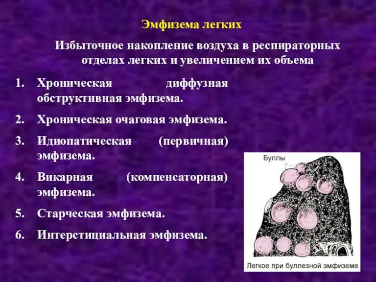 Избыточное накопление воздуха в респираторных отделах легких и увеличением их