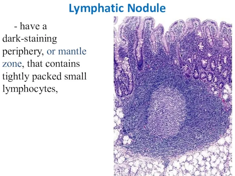 Lymphatic Nodule - have a dark-staining periphery, or mantle zone, that contains tightly packed small lymphocytes,