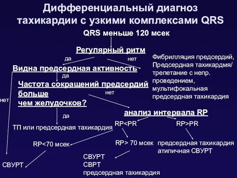 Дифференциальный диагноз тахикардии с узкими комплексами QRS Фибрилляция предсердий, Предсердная