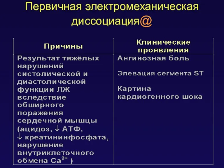 Первичная электромеханическая диссоциация@