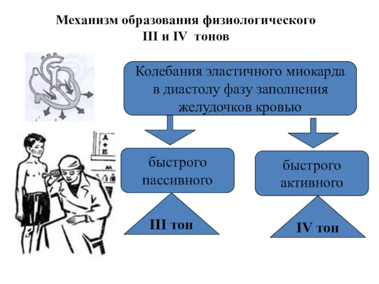 Механизм образования физиологического III и IV тонов Колебания эластичного миокарда