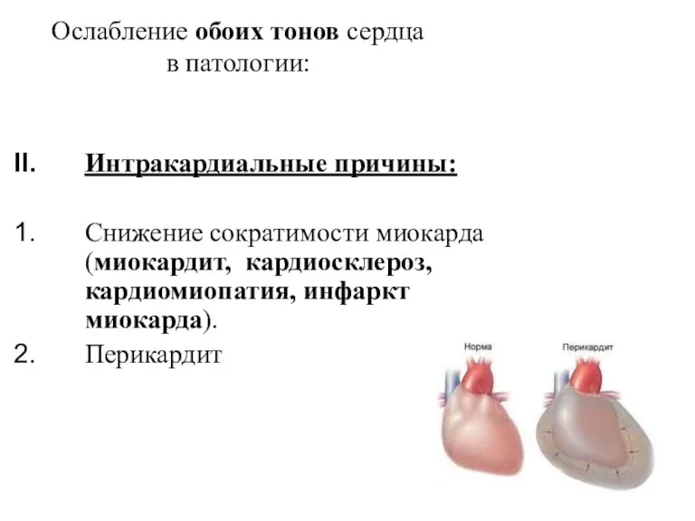 Ослабление обоих тонов сердца в патологии: Интракардиальные причины: Снижение сократимости