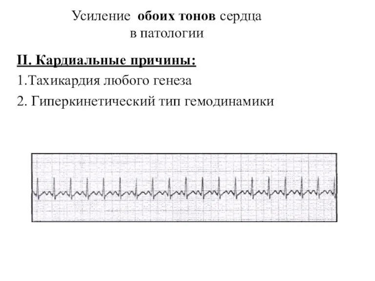 II. Кардиальные причины: 1.Тахикардия любого генеза 2. Гиперкинетический тип гемодинамики Усиление обоих тонов сердца в патологии